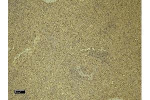 (ABIN334381) (8 μg/mL) staining of paraffin embedded Human Spleen. (CXCR3 anticorps  (C-Term))