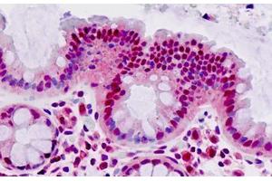 Human Colon: Formalin-Fixed, Paraffin-Embedded (FFPE)