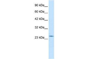 WB Suggested Anti-RGS13 Antibody Titration:  0. (RGS13 anticorps  (Middle Region))