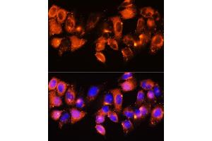 Immunofluorescence analysis of HeLa cells using IGFBP5 antibody (ABIN6130485, ABIN6142257, ABIN6142259 and ABIN6216084) at dilution of 1:100. (IGFBP5 anticorps  (AA 68-167))