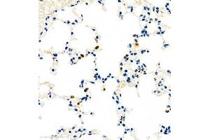 Immunohistochemistry of paraffin embedded rat pneumonia using CCL3 (ABIN7073450) at dilution of 1:1000 (400x lens)