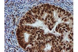 Image no. 1 for anti-Fragile X Mental Retardation 1 (FMR1) antibody (ABIN1498287)