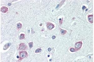 Human Brain, Cortex (formalin-fixed, paraffin-embedded) stained with BNIP3 antibody ABIN461995 at 10 ug/ml followed by biotinylated anti-mouse IgG secondary antibody ABIN481714, alkaline phosphatase-streptavidin and chromogen.