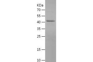 Western Blotting (WB) image for Monoamine Oxidase A (MAOA) (AA 129-319) protein (His-IF2DI Tag) (ABIN7124016)