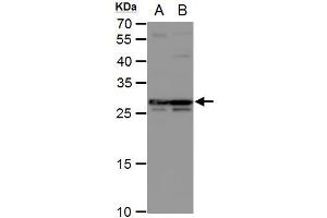 WB Image DCK antibody detects DCK protein by western blot analysis.