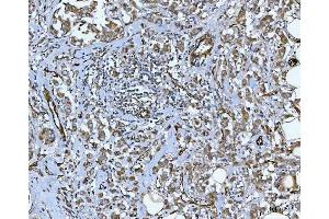 IHC analysis of PTRF/CAVIN1 using anti-PTRF/CAVIN1 antibody (ABIN7601817). (PTRF anticorps  (AA 47-390))