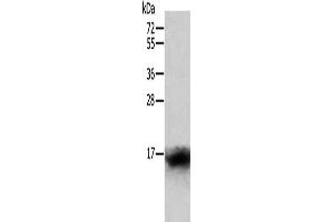 Gel: 12 % SDS-PAGE, Lysate: 40 μg, Lane: Human lymphoma tissue, Primary antibody: ABIN7128814(CCL24 Antibody) at dilution 1/400, Secondary antibody: Goat anti rabbit IgG at 1/8000 dilution, Exposure time: 1 minute (CCL24 anticorps)