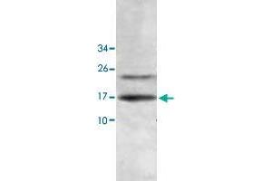 Western blot analysis of human fetal liver lysate with HINT2 polyclonal antibody  at 1 : 500 dilution. (HINT2 anticorps  (AA 59-163))