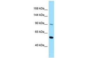 Image no. 1 for anti-Colony Stimulating Factor 2 Receptor, Beta (CSF2RB) (AA 578-627) antibody (ABIN6748119) (CD131 anticorps  (AA 578-627))