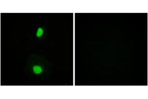 Immunofluorescence analysis of HeLa cells, using TIP60 (Ab-86) Antibody. (KAT5 anticorps  (AA 52-101))