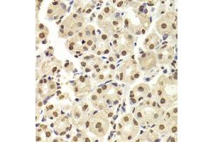 Immunohistochemistry of paraffin-embedded human stomach using HNRNPD Antibody.