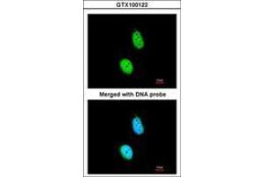 Image no. 2 for anti-Excision Repair Cross-Complementing Rodent Repair Deficiency, Complementation Group 8 (ERCC8) (AA 1-164) antibody (ABIN467383)