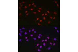 Immunofluorescence analysis of U2OS cells using CTBP2 Rabbit mAb (ABIN7265979) at dilution of 1:100 (40x lens). (CTBP2 anticorps)