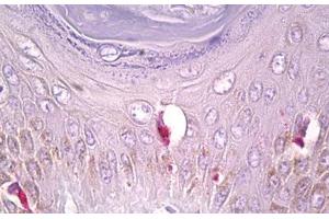 Anti-PLCG1 antibody IHC staining of human skin, Langerhans cell. (Phospholipase C gamma 1 anticorps  (AA 751-800))