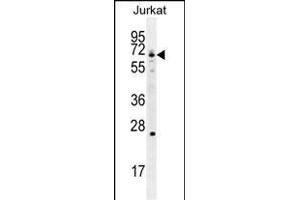 GCLC Antibody (N-term) (ABIN655884 and ABIN2845285) western blot analysis in Jurkat cell line lysates (35 μg/lane). (GCLC anticorps  (N-Term))