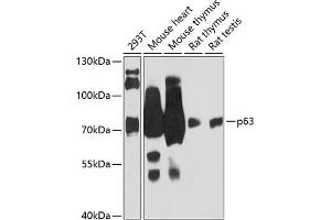 Western blot analysis of extracts of various cell lines, using p63 antibody (ABIN6133473, ABIN6149426, ABIN6149429 and ABIN6216798) at 1:3000 dilution. (p63 anticorps  (AA 1-160))