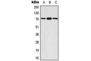 Western blot analysis of S6K1 (pS447) expression in A549 EGF-treated (A), mouse brain (B), rat brain (C) whole cell lysates. (RPS6KB1 anticorps  (C-Term, pSer447))