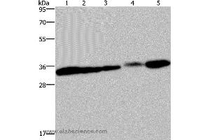 Western blot analysis of HUVEC and 293T cell, mouse bladder, human placenta and mouse kidney tissue, using CLDN23 Polyclonal Antibody at dilution of 1:200 (Claudin 23 anticorps)