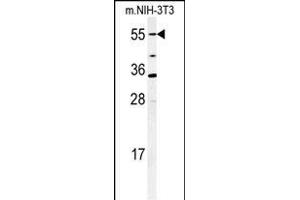 Western blot analysis of CYP26A1 Antibody (C-term) (ABIN650717 and ABIN2837925) in mouse NIH-3T3 cell lysates (35 μg/lane). (CYP26A1 anticorps  (C-Term))