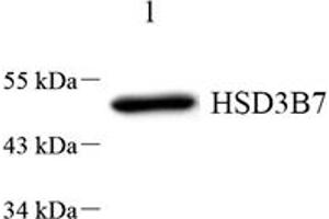Western blot analysis of HSD3B7 (ABIN7074263) at dilution of 1: 1000,Lane 1: HeLa cell lysate (HSD3B7 anticorps)