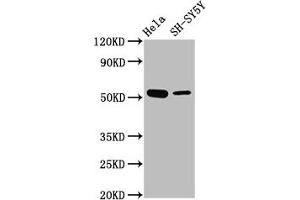 Western Blot Positive WB detected in: Hela whole cell lysate, SH-SY5Y whole cell lysate All lanes: MEX3A antibody at 4. (MEX3A anticorps  (AA 416-466))