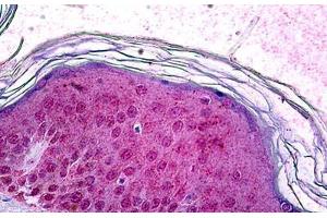 Human Skin: Formalin-Fixed, Paraffin-Embedded (FFPE) (SOX10 anticorps)
