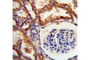 Immunohistochemistry analysis in human kidney tissue (Formalin-fixed, Paraffin-embedded) using DNAJC22  Antibody  (C-term), followed by peroxidase conjugated secondary antibody and DAB staining.
