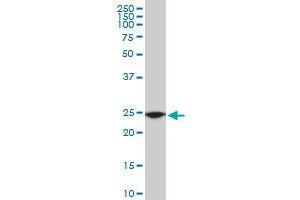 Image no. 4 for anti-Ribosomal Protein L19 (RPL19) (AA 1-101) antibody (ABIN465969)