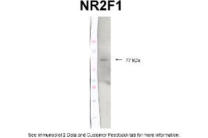 WB Suggested Anti-N32F1 Antibody Titration: 2 ug/mlPositive Control: Protein extracts, Chicken brain tissue (NR2F1 anticorps  (C-Term))