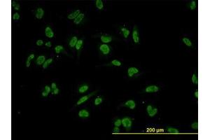 Image no. 3 for anti-Tripartite Motif Containing 24 (TRIM24) (AA 432-569) antibody (ABIN599067) (TRIM24 anticorps  (AA 432-569))