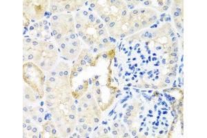 Immunohistochemistry of paraffin-embedded Mouse kidney using TDGF1 Polyclonal Antibody at dilution of 1:100 (40x lens).