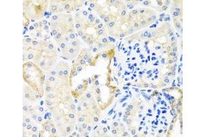 Immunohistochemistry of paraffin-embedded Mouse kidney using TDGF1 Polyclonal Antibody at dilution of 1:100 (40x lens). (TDGF1 anticorps)