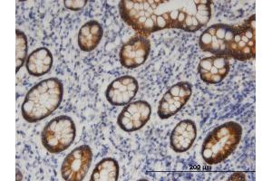 Immunoperoxidase of monoclonal antibody to PNPLA6 on formalin-fixed paraffin-embedded human small Intestine.