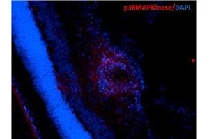 Immunohistochemistry analysis using Mouse Anti-p38 MAPK Monoclonal Antibody, Clone 9F12 (ABIN361679 and ABIN361680).