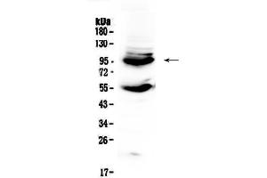 Western blot analysis of CD105 using anti-CD105 antibody . (Endoglin anticorps  (AA 27-226))