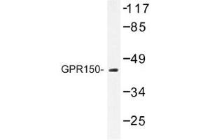 Image no. 1 for anti-G Protein-Coupled Receptor 150 (GPR150) antibody (ABIN317693) (GPR150 anticorps)