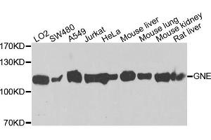 Western blot analysis of extracts of various cells, using GNE antibody. (GNE anticorps)