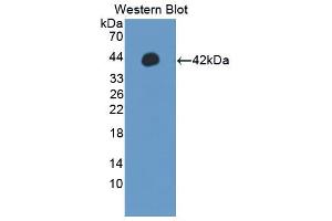 Western blot analysis of the recombinant protein. (IRF5 anticorps  (AA 136-475))
