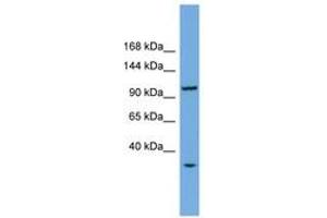 Image no. 1 for anti-CTF18, Chromosome Transmission Fidelity Factor 18 Homolog (CHTF18) (AA 755-804) antibody (ABIN6745169) (CTF18 anticorps  (AA 755-804))
