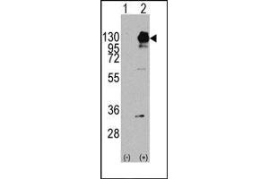 Image no. 1 for anti-Platelet Derived Growth Factor Receptor alpha (PDGFRA) (Tyr754) antibody (ABIN359914) (PDGFRA anticorps  (Tyr754))