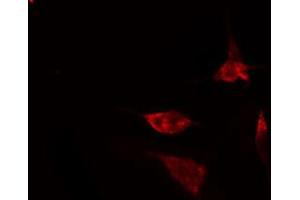 ABIN6274499 staining Hela cells by IF/ICC.