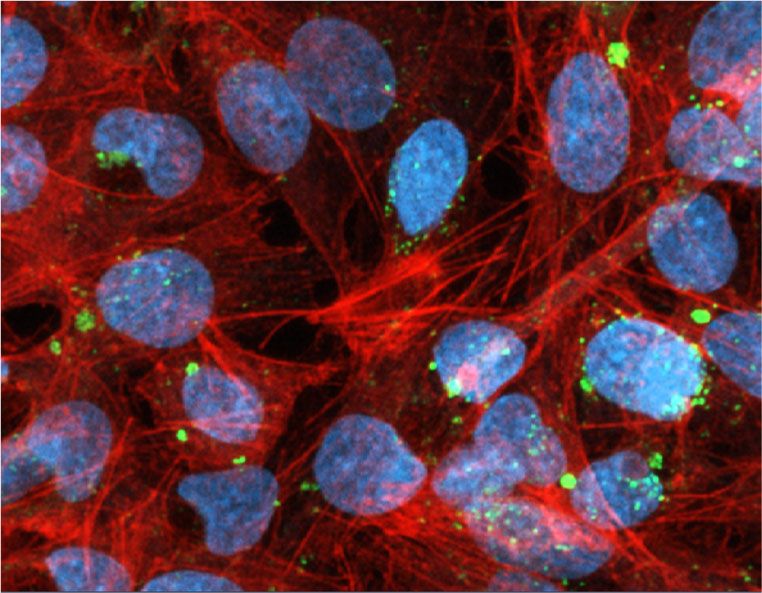 Immunofluorescence detection of lumasiran siRNA in HepG2 cells using ModDetect Anti-2′-OMe clone OME3. Co-stained with phalloidin (cytoskeleton) and DAPI (nuclei).